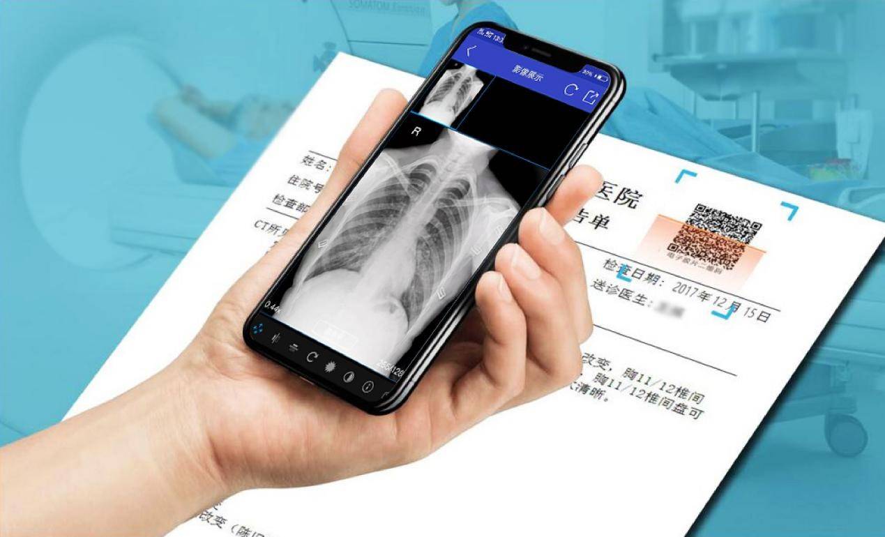云膠片是什么？